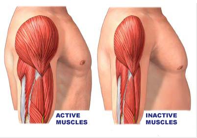 atrophie des muscles