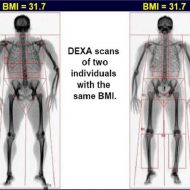 Muscle bmi