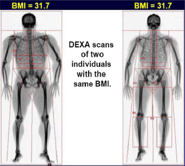 muscle bmi
