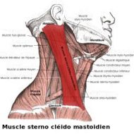 Muscle du cou douloureux