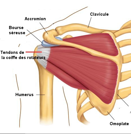 muscle omoplate douleur