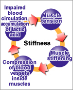 muscle stiffness