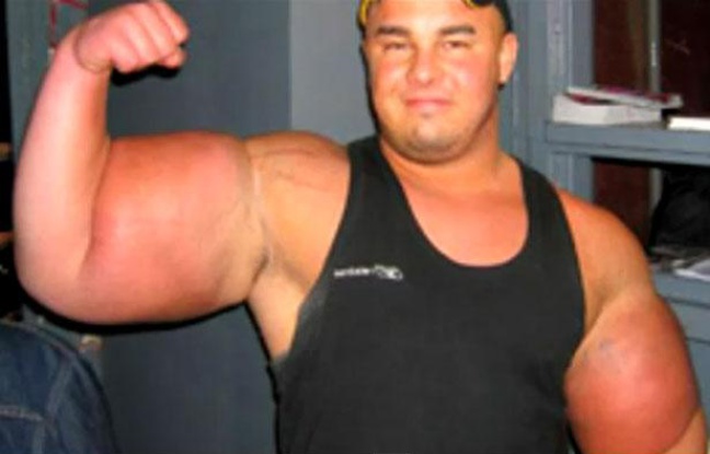 muscle synthol