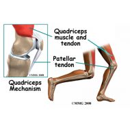 Muscle tendonitis