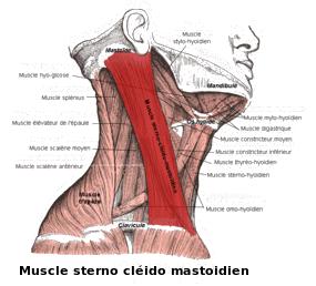 muscles du cou douloureux