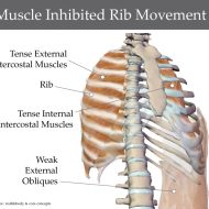 Rib muscle pain