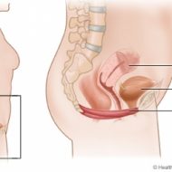Tighten vaginal muscles